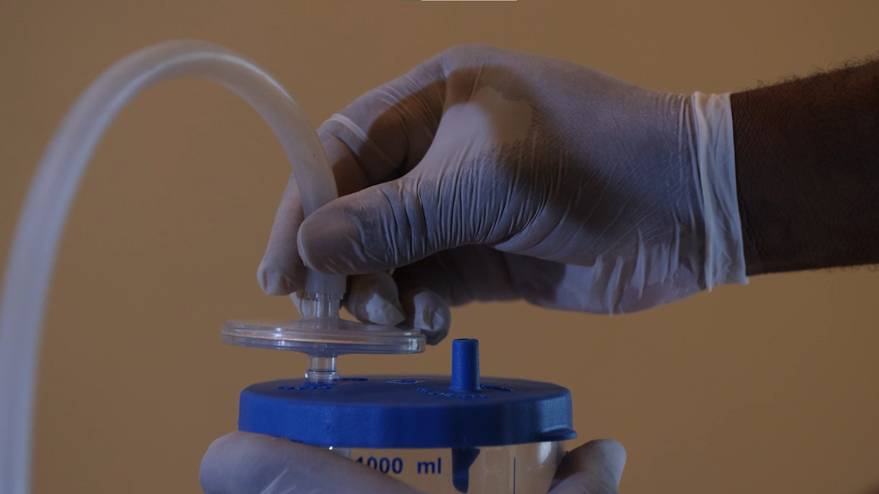 Pumani CPAP - Checking pump