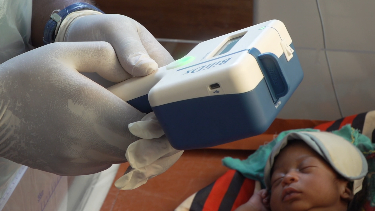 Pumani CPAP - The machine does not turn on